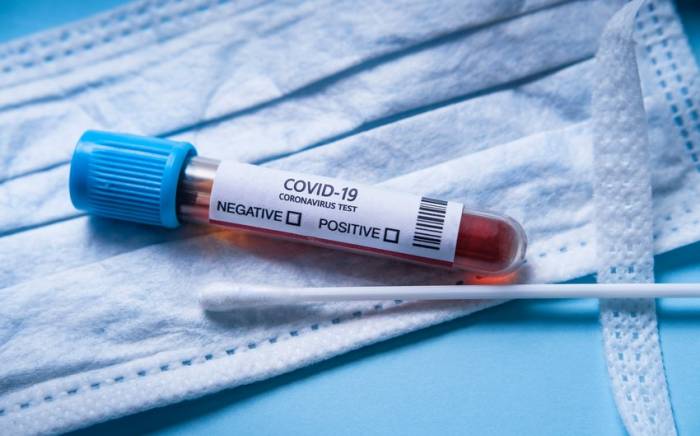 За последние сутки коронавирусом заразились 377 человек