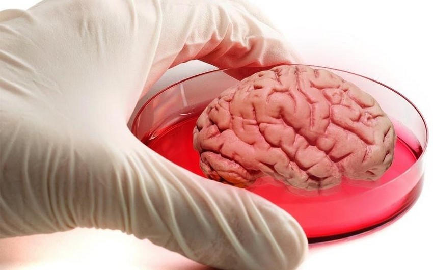 Израильские ученые создали имплант спинного мозга из жира человека
