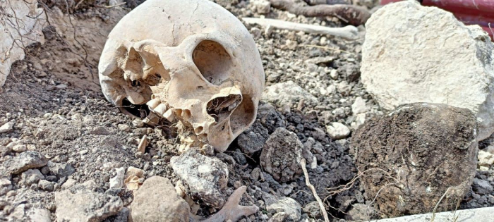 В селе Фаррух найдены останки еще нескольких азербайджанцев - ФОТО+ ВИДЕО