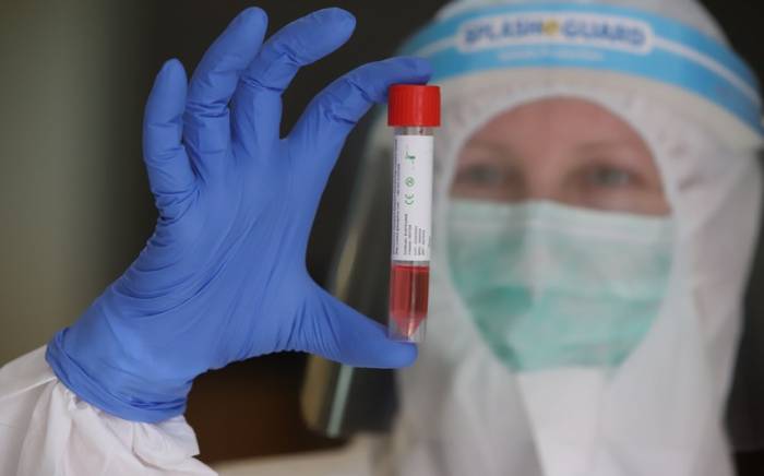 В Азербайджане коронавирусом заразились еще 47 человек
