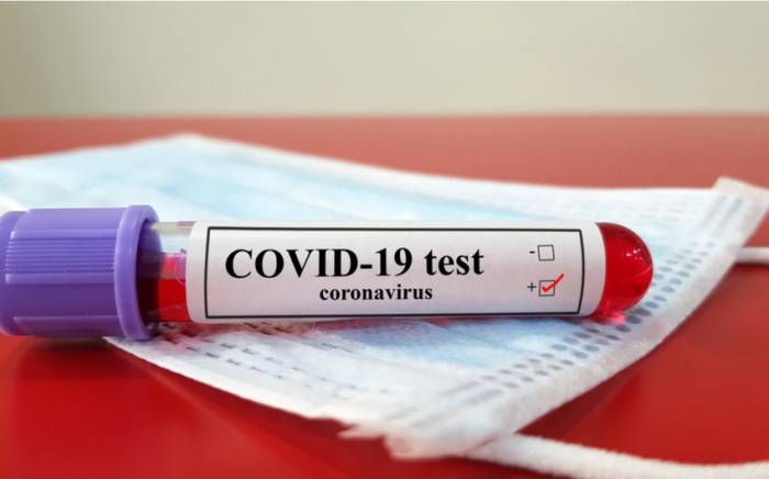 В Азербайджане за сутки 33 человека заразились коронавирусом
