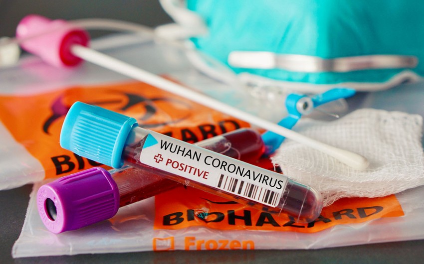 В Азербайджане коронавирусом заразились еще 16 человек
