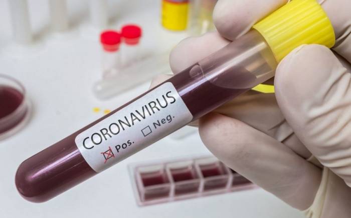 В Азербайджане за последние сутки не выявлено случаев заражения коронавирусом

