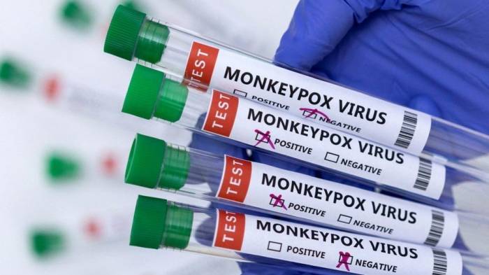 Всемирная организация здравоохранения созовет чрезвычайный комитет из-за оспы обезьян
