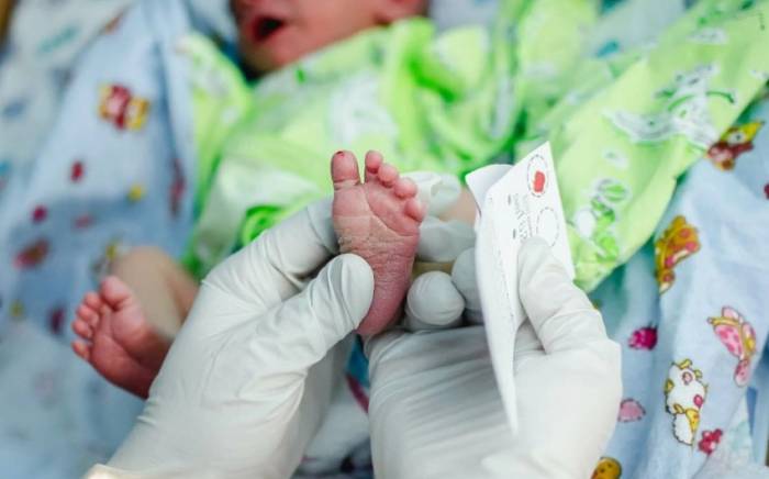 Завотделением: В Азербайджане скрининг новорожденных является добровольным
