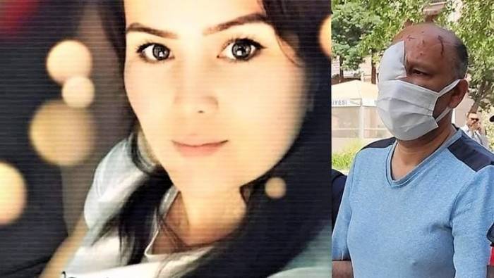 В Турции скончалась гражданка Узбекистана, после того как ее облил кислотой бойфренд
