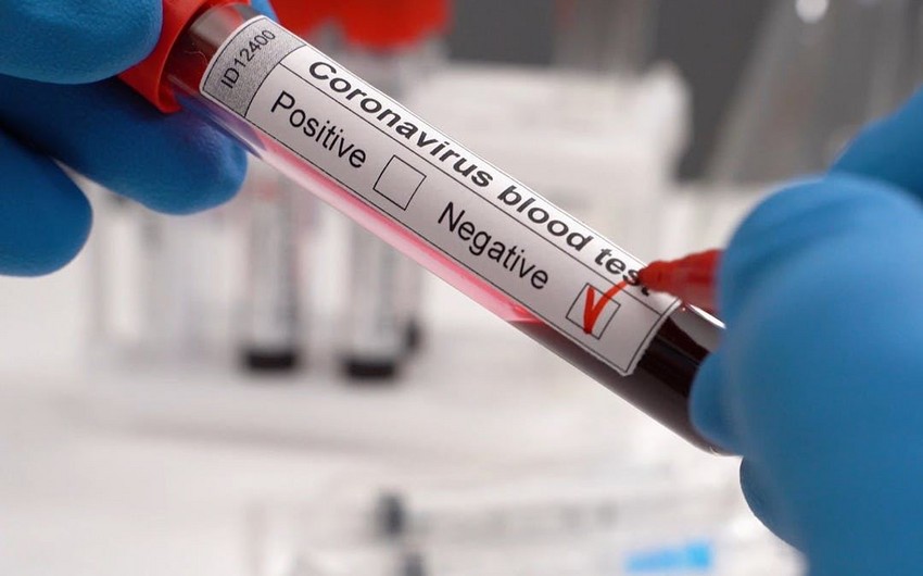 Инфекционист: В Азербайджане пока нет вероятности повторного массового заражения коронавирусом