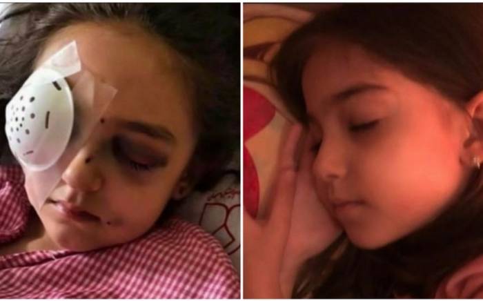 В Иране в результате открытого полицейскими огня девочка потеряла глаз
