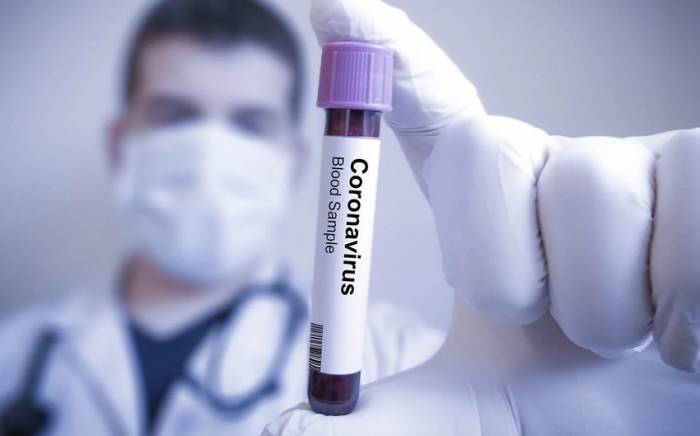 В Азербайджане за сутки 68 человек заразились коронавирусом, двое скончались
