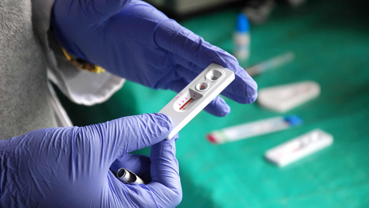 В Италии станет бесплатным лекарство для предотвращения заражения ВИЧ
