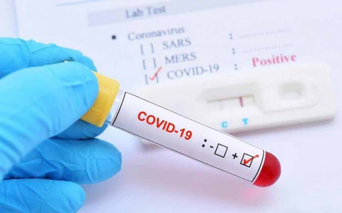 В Азербайджане за сутки коронавирусом заразились 29 человек
