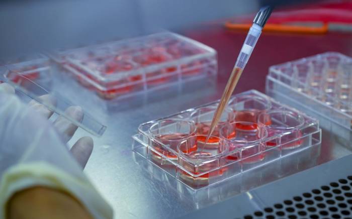 Ученые провели первую фазу испытаний клеточной терапии рассеянного склероза

