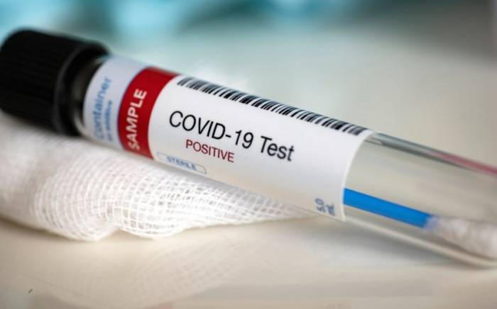 Заболеваемость COVID-19 в России за неделю увеличилась почти на 10%
