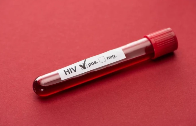 Сколько ВИЧ-инфицированных зарегистрировано в Азербайджане?
