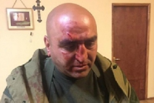 В Армении задержан преступник, напавший на противников Саргсяна