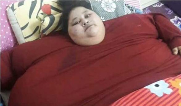 Самая тяжелая женщина в мире похудела на 140 кг 