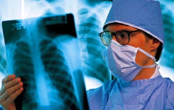 Обнародовано число больных туберкулезом в Азербайджане