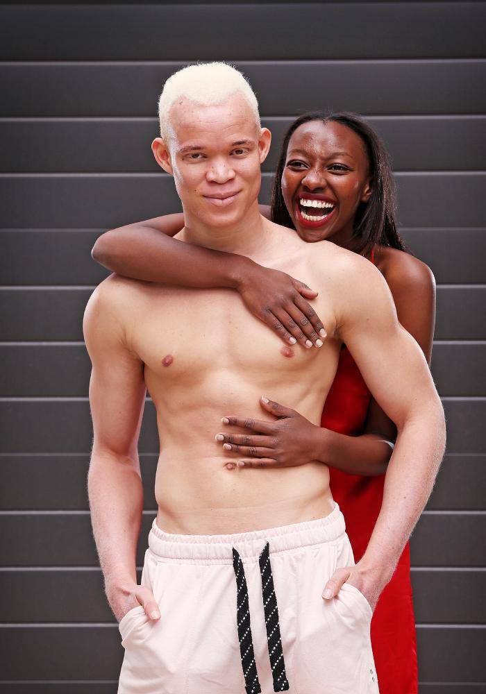 Парень-альбинос из Африки покорил мир моды (ФОТО)