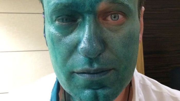 Навальный вновь в `зеленке`