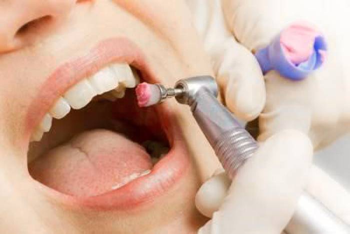 Cтоматолог обманом удалила пациентке 22 здоровых зуба