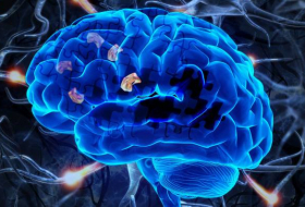 Ученые из США случайно открыли лекарство от болезни Альцгеймера
