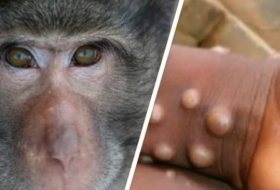 ВОЗ сообщила о более 3,1 тыс. случаях оспы обезьян в мире с начала года