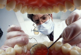 Ученые: По зубам можно узнать, сколько осталось жить человеку