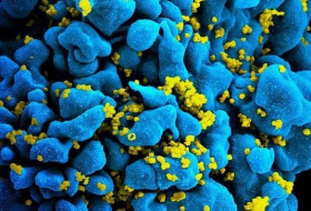 Комбинация антител от ВИЧ прошла первое клиническое испытание