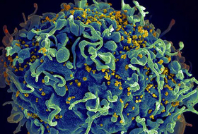 Иммунотерапия ВИЧ прошла первую фазу клинических испытаний
