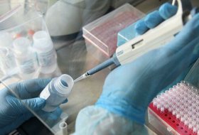 В Азербайджан планируется привезти дополнительные тесты на коронавирус
