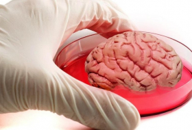 Израильские ученые создали имплант спинного мозга из жира человека
