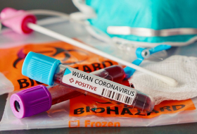 В Азербайджане коронавирусом заразились еще 16 человек
