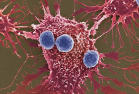 Ученые научили раковые клетки бороться с самой опухолью
