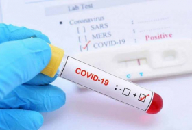 В Азербайджане за сутки коронавирусом заразились 29 человек
